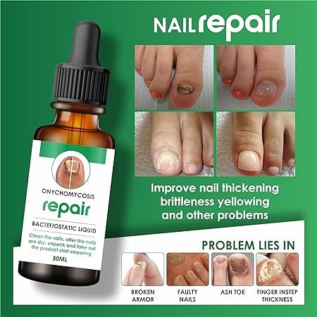 💅 Buy 1 Get 2 FREE -🧴 Nail Growth & Repair Serum ✨