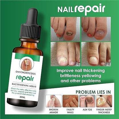💅 Buy 1 Get 2 FREE -🧴 Nail Growth & Repair Serum ✨