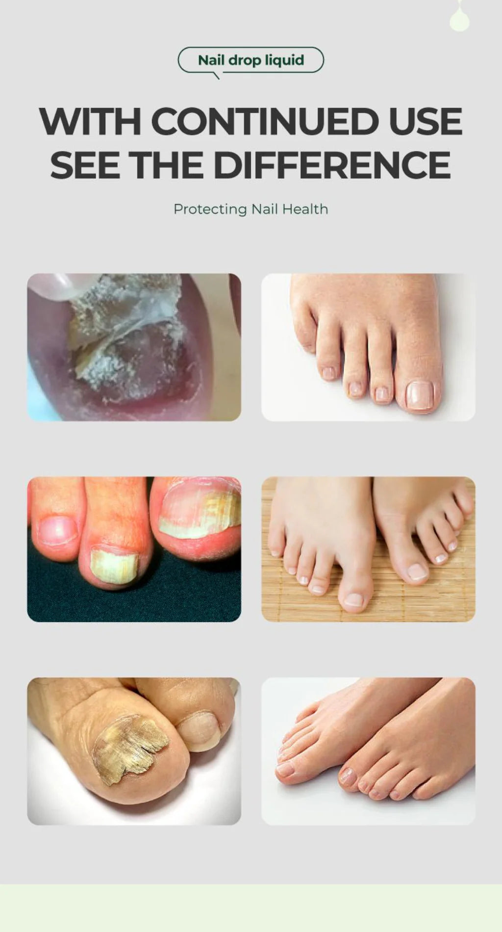 💅 Buy 1 Get 2 FREE -🧴 Nail Growth & Repair Serum ✨