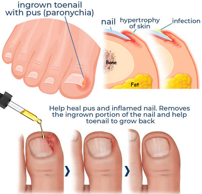 💅 Buy 1 Get 2 FREE -🧴 Nail Growth & Repair Serum ✨